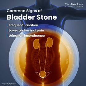 BLADDER STONE TREATMENT