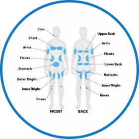 Laser Hair Removal and Medspa