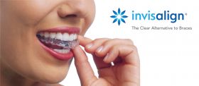 Implant Dentist Bucks County