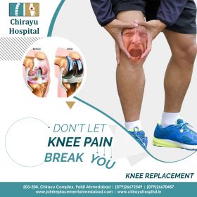 Knee Replacement Surgery, Knee Joints Surgeon - Joint Replacement Ahmedabad