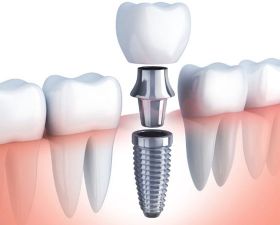capitaldentalcare