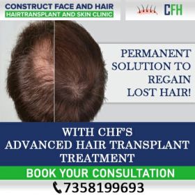 Hair Loss Treatment in Chennai - CFH Hair Transplant