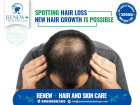 Renew+ Hair Clinic