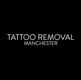 Tattoo Removal Manchester