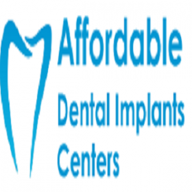 Affordable Dental Implants Queens