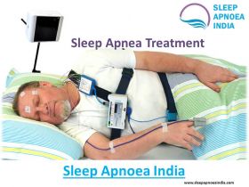 Sleep Apnea Devices