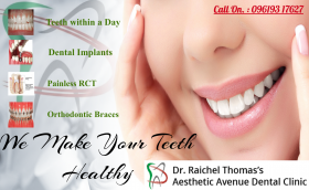 Dental Implant - Asthetic Avenue Best dental clinic in nerul - Dr. Raichel Thomas