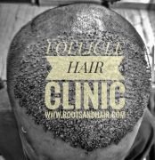 Follicle Hair Clinic