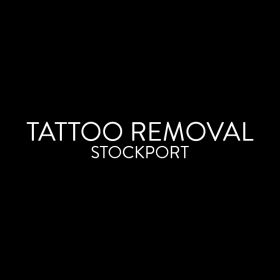 TATTOO REMOVAL STOCKPORT