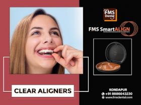 FMS Smart Align