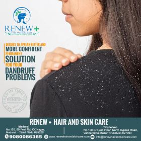 Dandruff Treatment