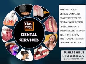 Dental Serives In Hyderabad India