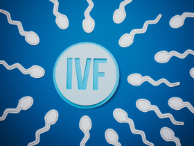 IVF Treatment