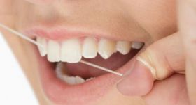 Periodontal Treatment Services in Dubai