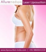 Laser Liposuction Mumbai