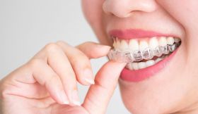 Clear Aligners & Invisible Braces for Straight