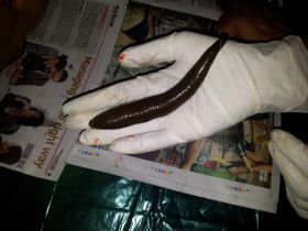 Leech Therapy For Skin Diseases