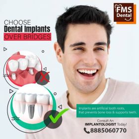  Best Dental Implant Clinic in India 