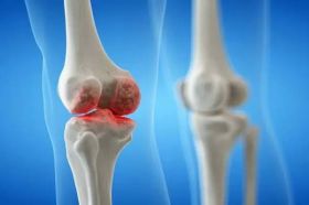 Bone & Joint Infection Treatment in Coimbatore