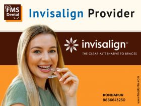 Invisalign