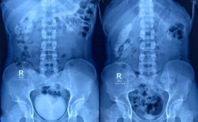 IVP, MCU & RGU Imaging Services in Navi Mumbai