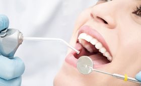 Best Dental Filling Clinic in Dubai