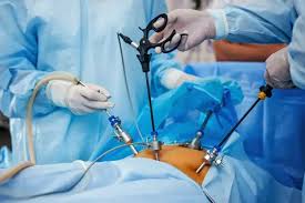 Advanced Laparoscopic Surgery