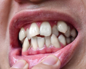 Orthodontist 