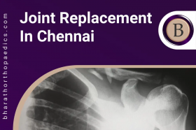 Joint Replacement in Chennai