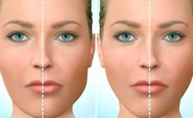 Face Surgery in Delhi