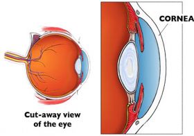 Cornea Specialist