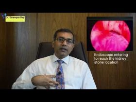 Best Kidney Stone Doctor/Specialist in Navi Mumbai