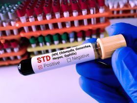 STD Testing Services in Kharghar