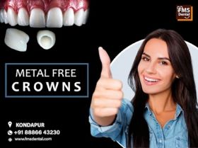 Zirconia Crowns