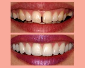 Cosmetic Dentistry