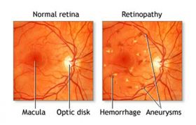 Retina Specialist