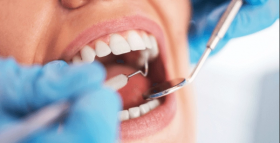 Orthodontic (Dental Braces) Treatment