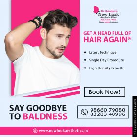 Best Hair Transplant Clinic in Hanamkonda