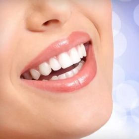 Teeth Whitening in Dubai