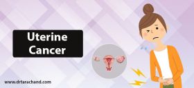 Uterine Cancer