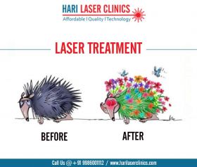 Piles Clinic in Bangalore