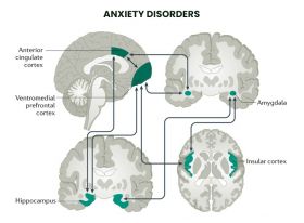 ANXIETY DISORDER TREATMENT  - Princeton, NJ