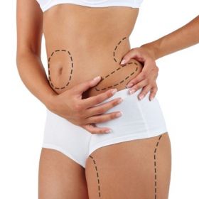 Vaser 4D Liposuction