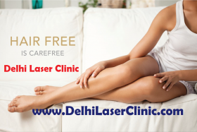 Laser Hair Removal