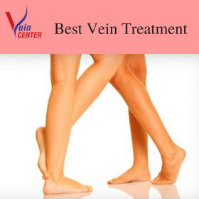 Get the Veins treatment at affordable cost