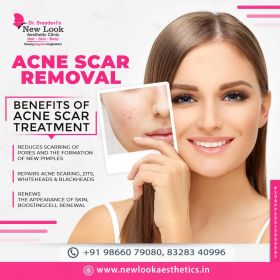 Acne Scars Treatment in Hanamkonda