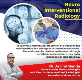 Best Interventional radiologist in Delhi NCR