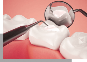 Restorative Dentistry