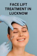 Face Lift Treatment in Lucknow