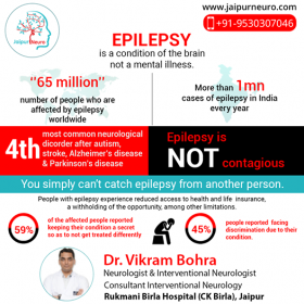 Epilepsy